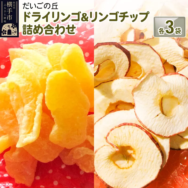 ドライリンゴ、りんごチップス詰め合わせ