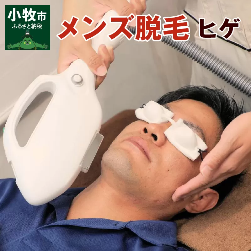 メンズ脱毛　ヒゲ